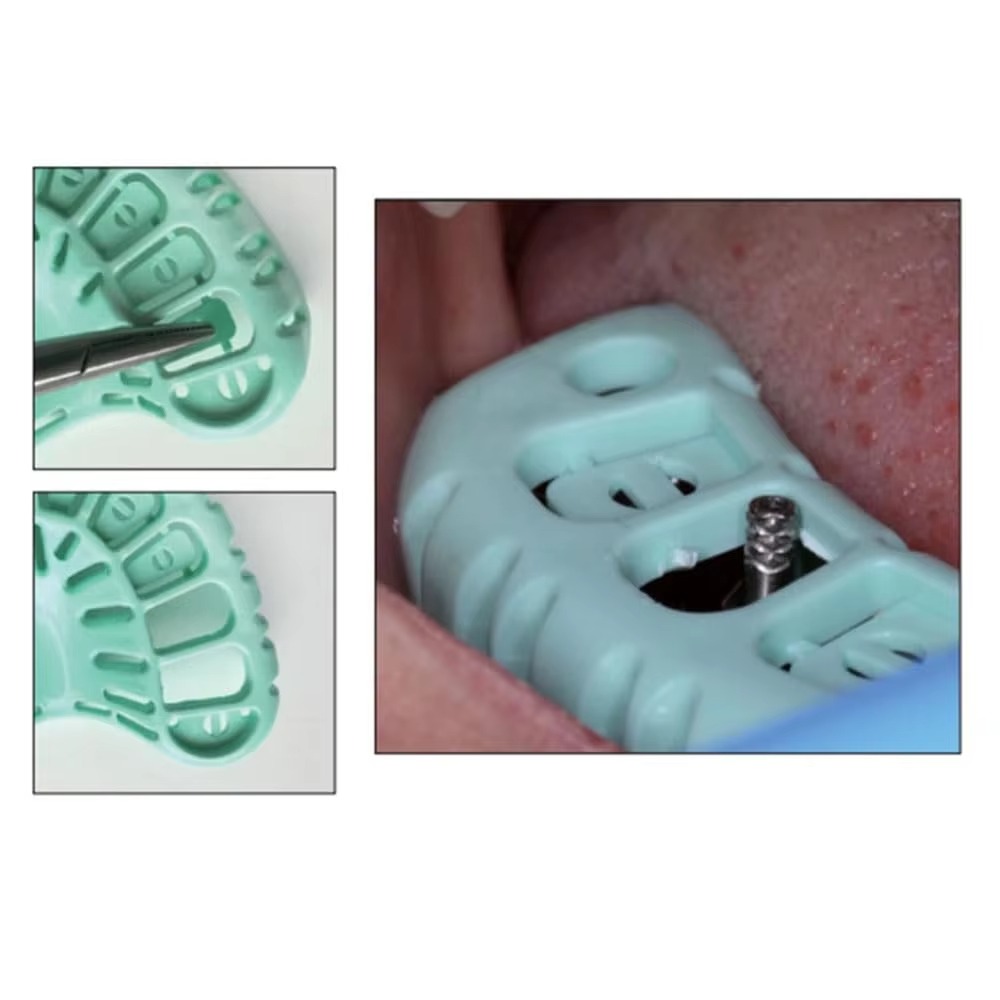 FULAIGE 6 pièces/ensemble, pla - Dental Impression Material Kit avis et prix