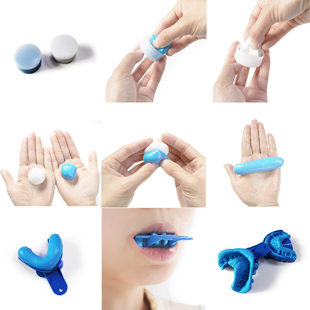 Luxsmile – Kit d'impression cl - Dental Impression Material Kit avis et prix