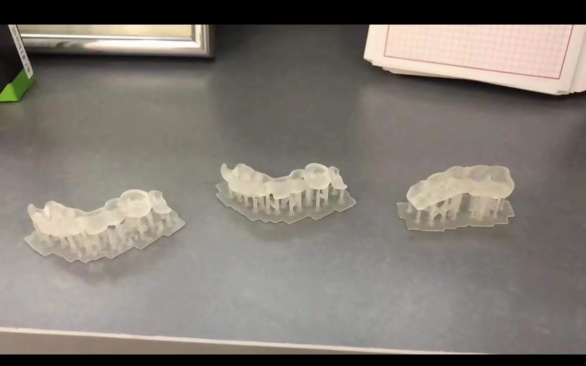 Guide de plantation d'impriman - Dental 3D Printer Resin avis et prix