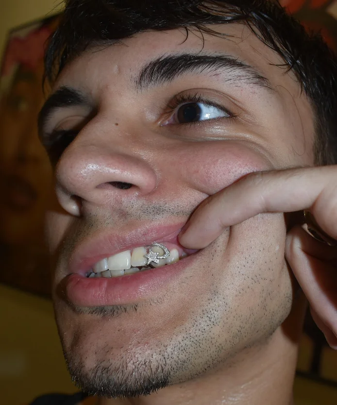 Grillz dentaires étoiles à den - Dental Zirconia Sintering Furnace avis et prix